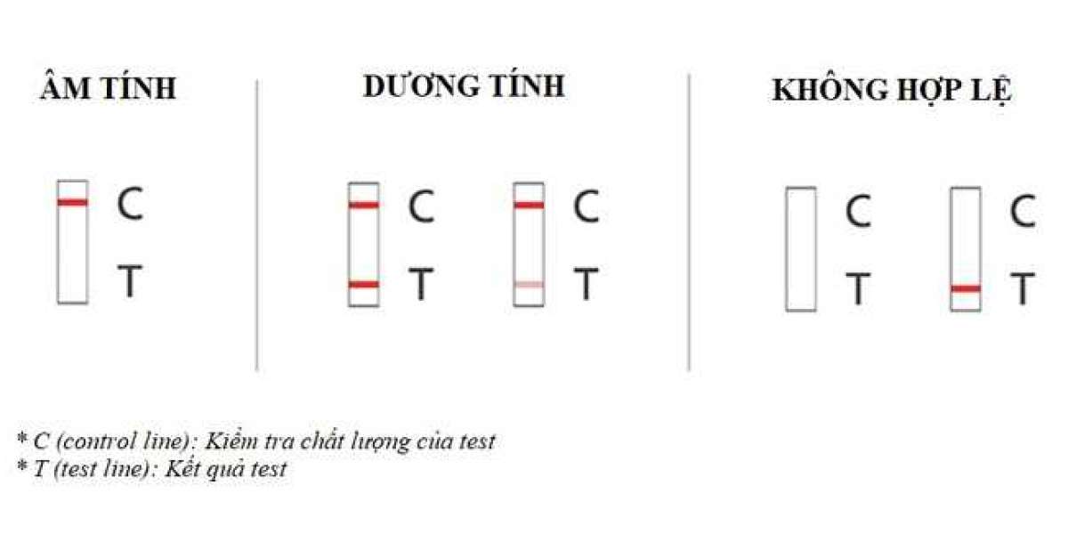 Hướng dẩn Cách đọc kết quả trên kit test Covid-19