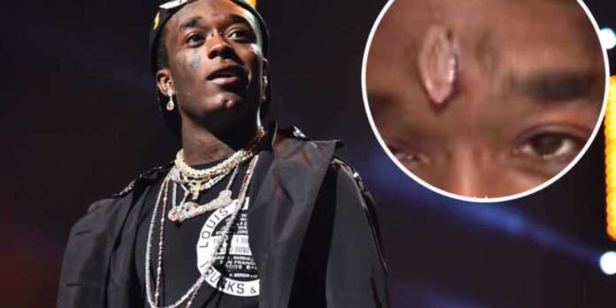 Fans Have Ripped Out Lil Uzi Vert Diamonds Out Of His Forehead