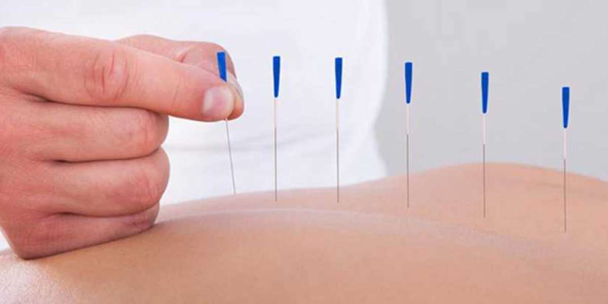 Muscle Recovery with Dry Needling