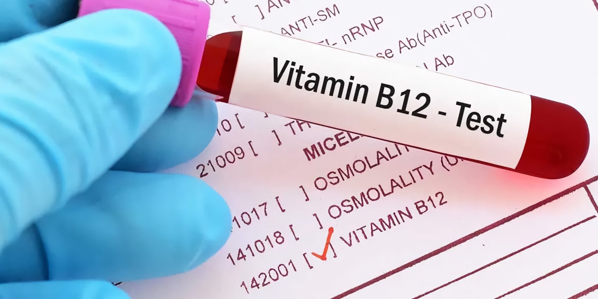 Active B12 Test Market Insights on Key Industry Opportunities & Drivers; MRFR Reveals the Forecast