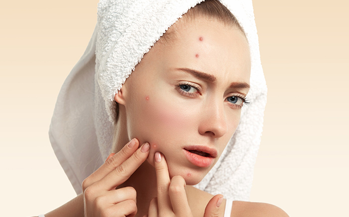 Acne Treatment In Singapore: Dermatologist Recommendations - Mirror Eternally