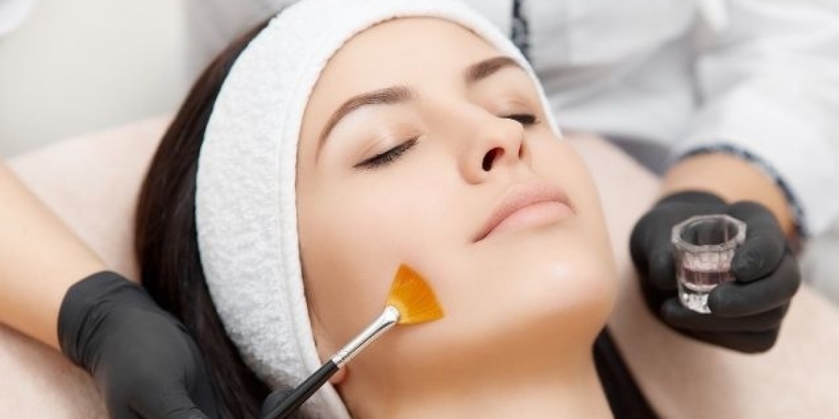 Preparing for a Derma Peel Procedure in Rockville, MD