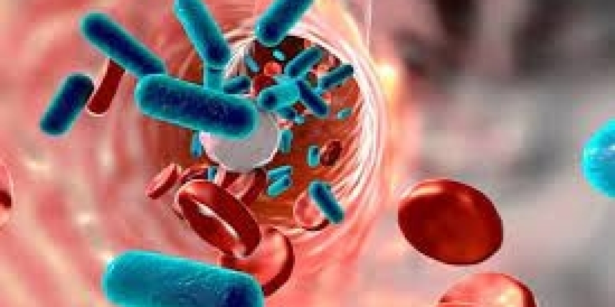 Sepsis Diagnostics Market Share, and Regional Growth Analysis 2033