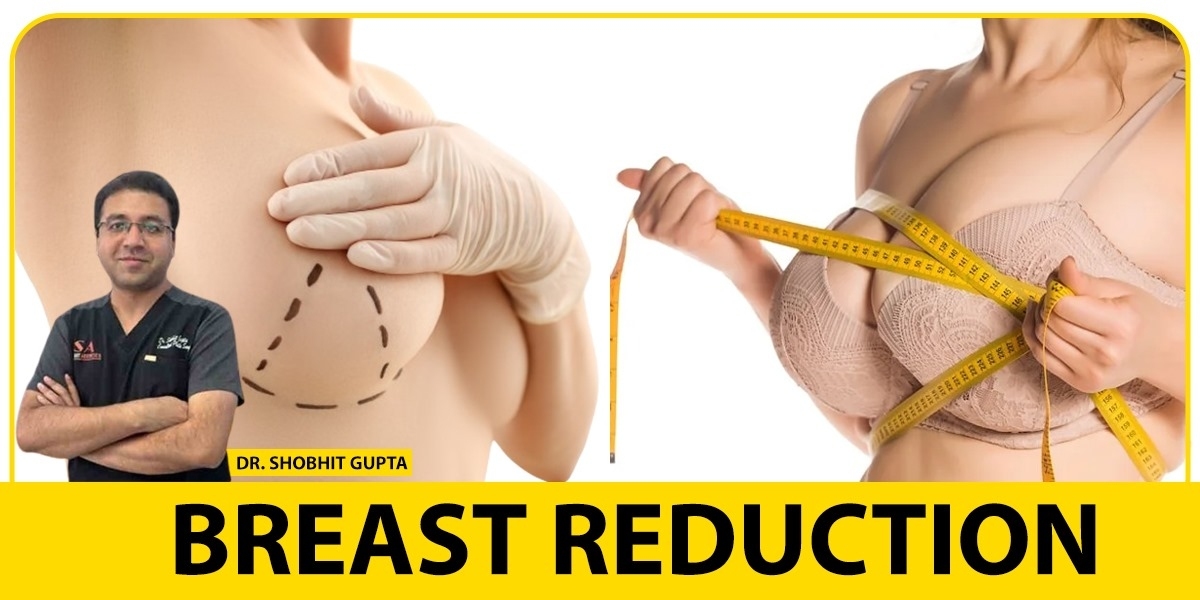 breast reduction surgery in Delhi