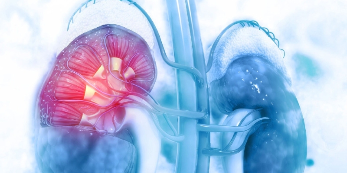 Acute Kidney Injury Market: Epidemiology, Trends, Demand, Share, Size (2024-2034)