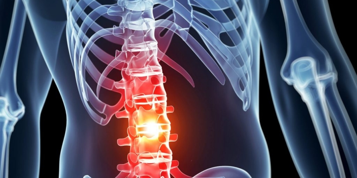 Exploring the World of Spinal Imaging: Understanding the Role of Spinal Imaging in Healthcare   