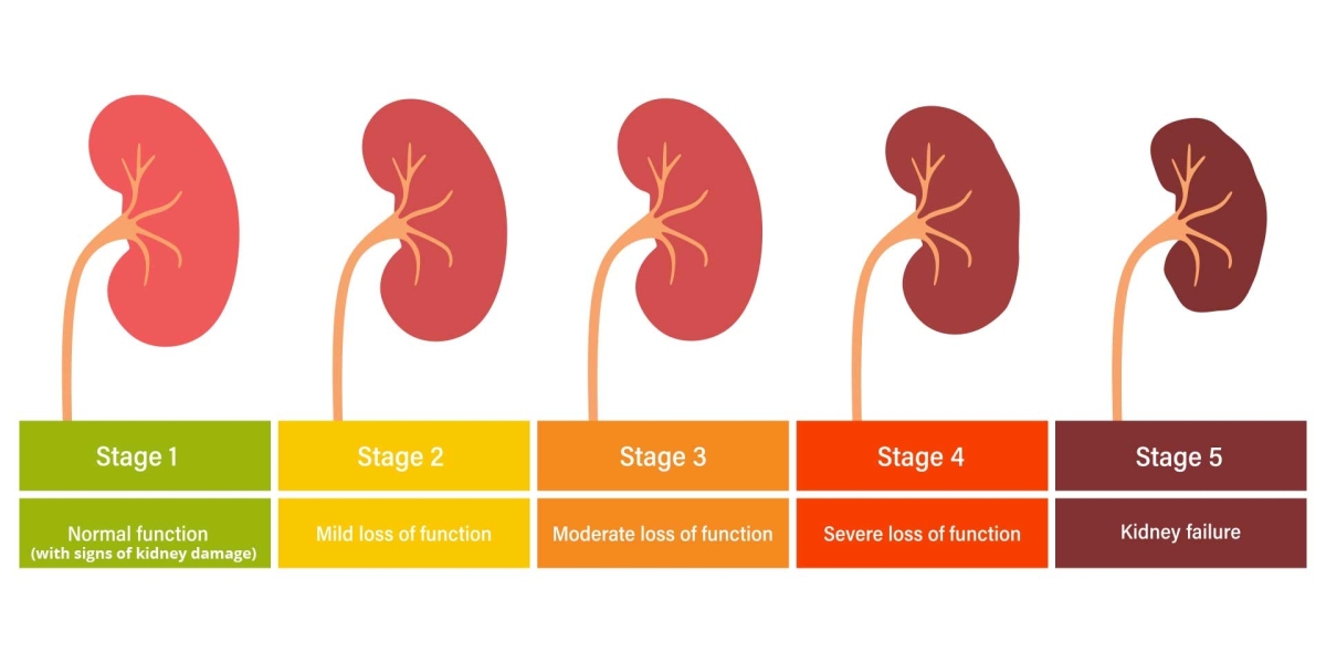 The Rise of CKD: How Early Detection and New Technologies are Shaping the Market