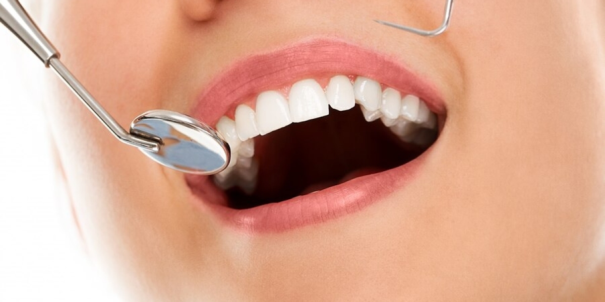 Emergency Dentist Cleveland Ohio: Immediate Dental Care in Cleveland