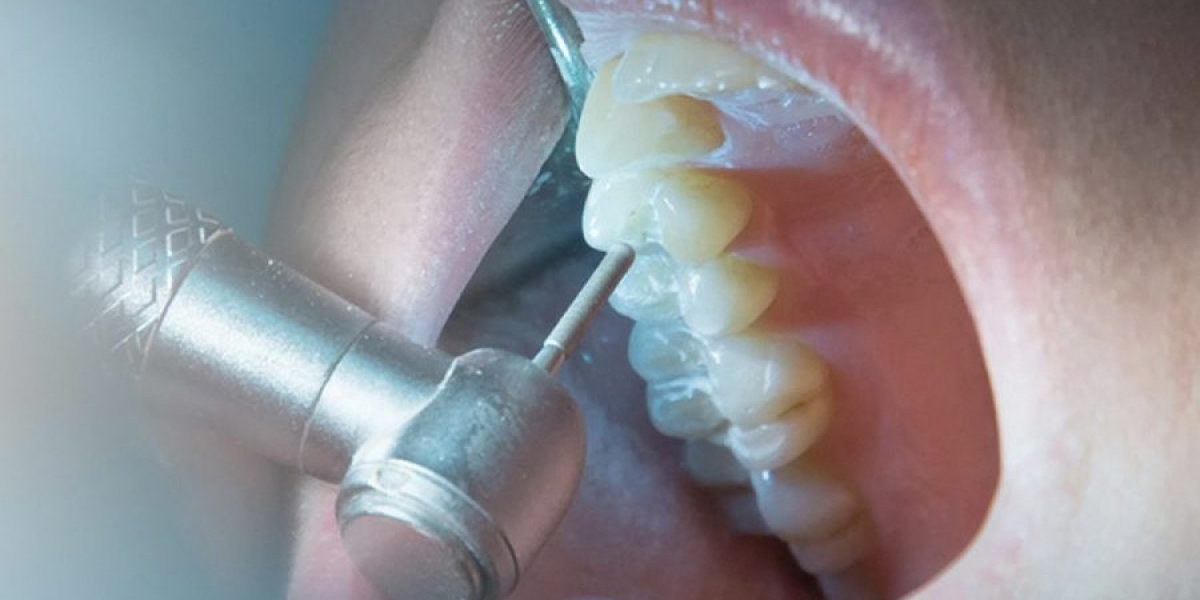 Endodontist in Dubai Premier