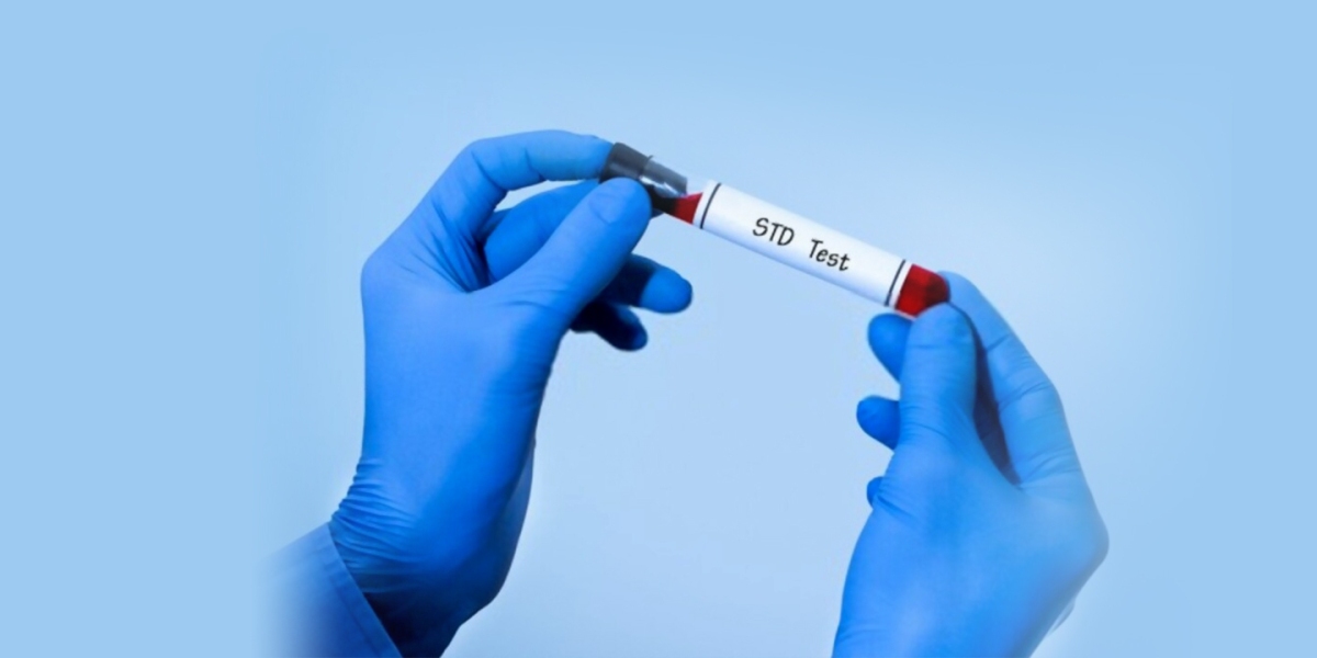 Diagnostic Testing of STDs Market: Insights into Laboratory and Point-of-Care Testing