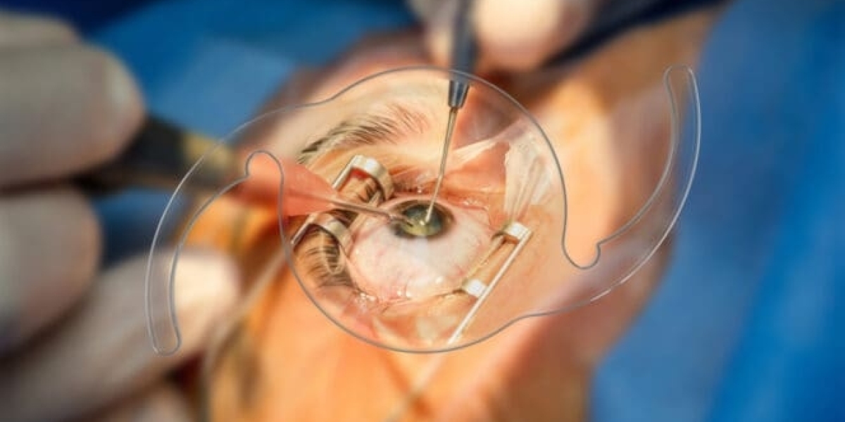 Intraocular Lens (IOL) Market Latest Technology, Size-Share, Future Growth, Supply-Demand Scenario 2032