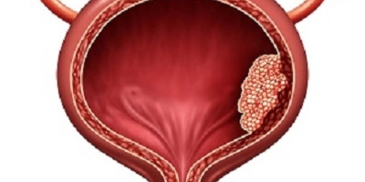 Bladder Cancer Market Report: Epidemiology, Industry Trends, Share, Size, Demand (2024-2034)Bladder Cancer Market Report