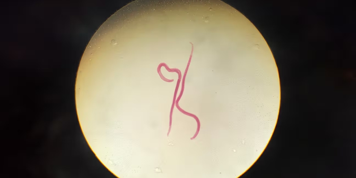 Psychological Impact of Living with Worm Infections