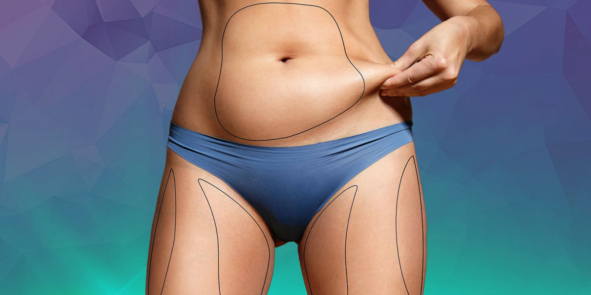 What is Tumescent Liposuction?