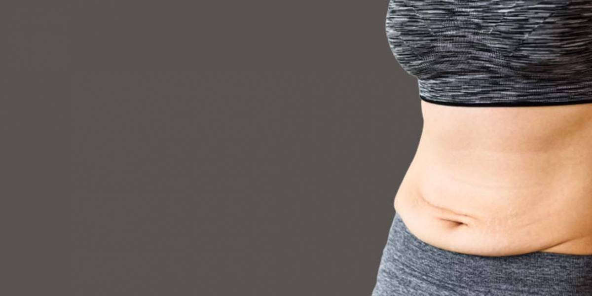 Best Tummy Tuck Surgeon  in Delhi