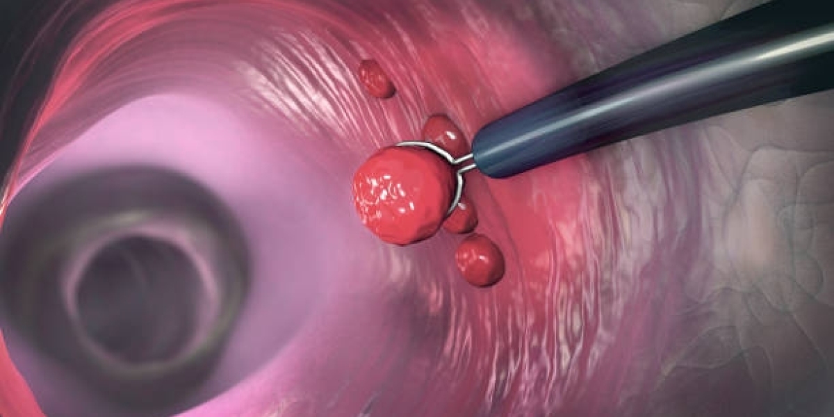 Rising Demand in the Cancer Biopsy Market: Liquid Biopsy, AI &amp; Precision Medicine